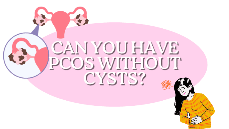Can You Have PCOS Without Cysts?